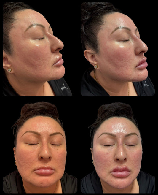 Facial Balancing Deposit